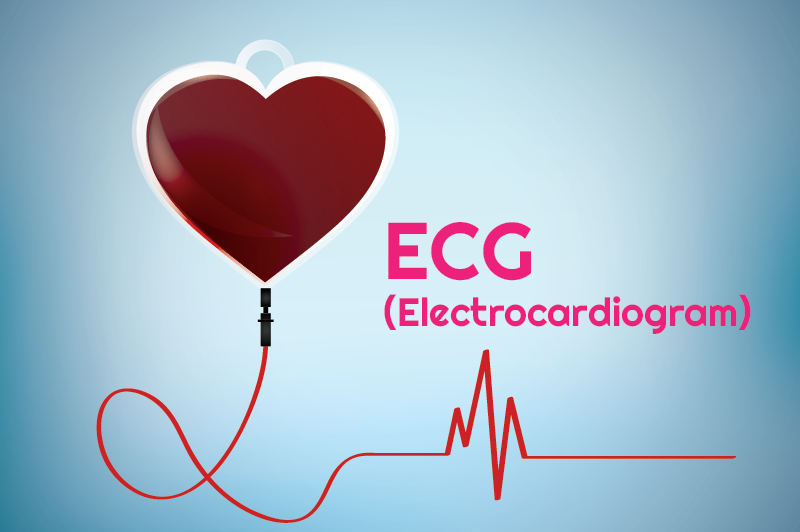 ECG – Electrocardiogram